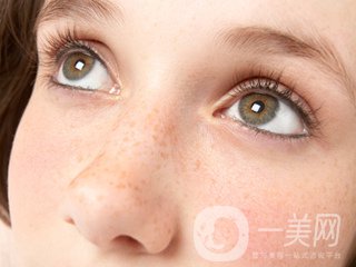 黃褐斑怎么形成的 怎么去除？