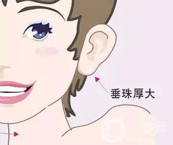 注射玻尿酸豐耳垂*果怎么樣？