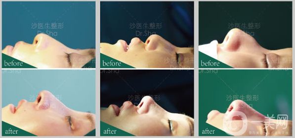 大連沙醫(yī)生新美鼻藝術節(jié)，帶你“預見·未來美”