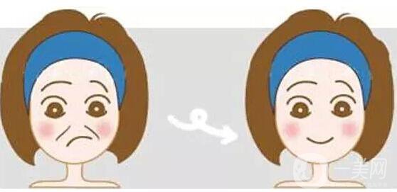 瑞蘭,注射除皺,多少錢(qián)