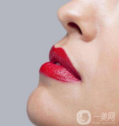 注射微晶瓷隆鼻多少錢 價格是多少