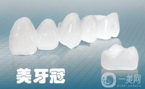 美容冠,多少錢(qián)