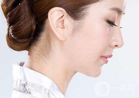 隆鼻危險嗎?隆鼻危險大嗎？