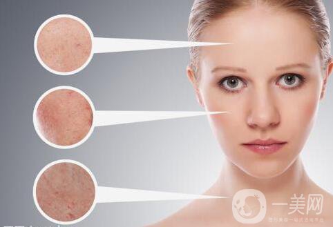 激光嫩膚價(jià)位 收費(fèi)情況介紹