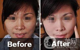 黑臉娃娃價(jià)格多少 收費(fèi)標(biāo)準(zhǔn)介紹