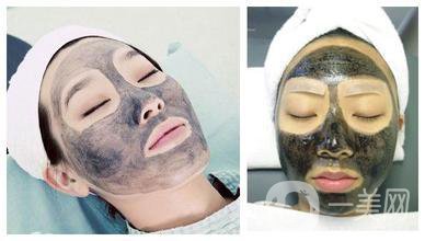 黑臉娃娃做一次多少錢 正規(guī)醫(yī)院收費多少錢？