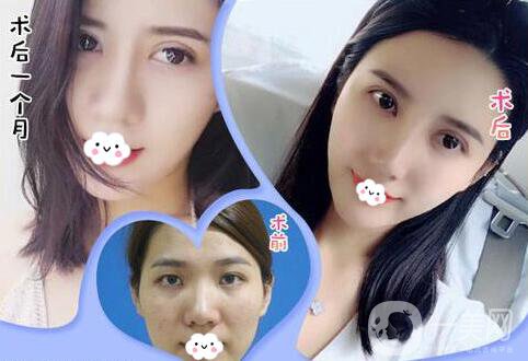 深圳鵬愛整形醫(yī)院價格表在線搶先看 更多專家坐診等你來！