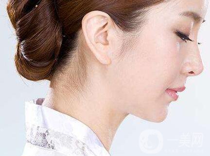 廣東鼻翼寬整形多少錢 鼻翼寬整形價(jià)格