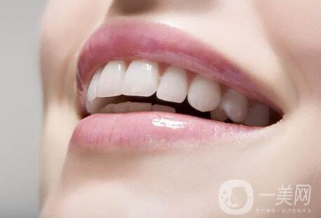 非金屬烤瓷牙價(jià)格一般是多少？