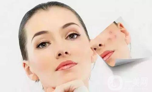 做一次果酸換膚大概需要多少錢？