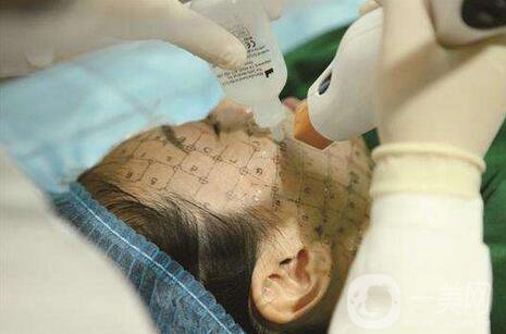 thermage熱瑪吉緊膚一次多少錢(qián)？