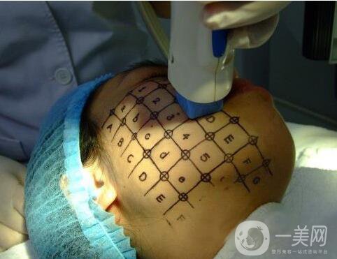 thermage熱瑪吉緊膚一次多少錢(qián)？