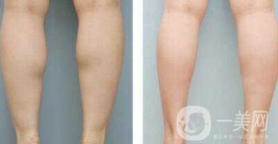 **果好嗎 打*怎么樣