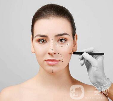 駝峰鼻矯正注意事項(xiàng)有哪些？