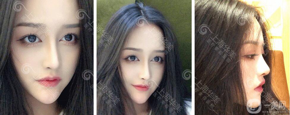 上海華美整形價格表2018發(fā)布 高級臉專屬定制項目曝光