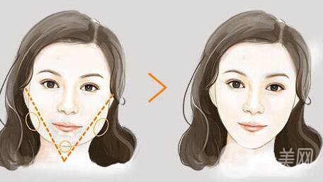 *價格一般多少錢？