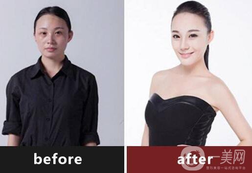 復(fù)合彩光調(diào)節(jié),*果