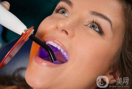 *潔牙注意事項有哪些？