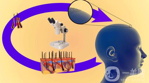 fut植發(fā)技術(shù),優(yōu)缺點(diǎn)