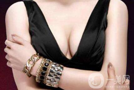 法國es假體隆胸,價格