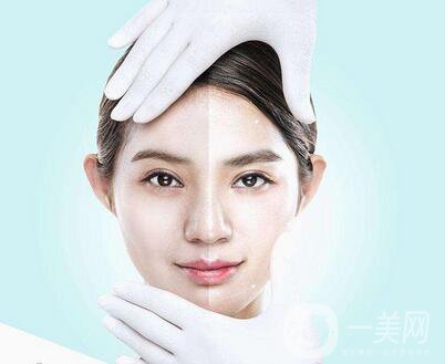 像束激光美白嫩膚功*有哪些？