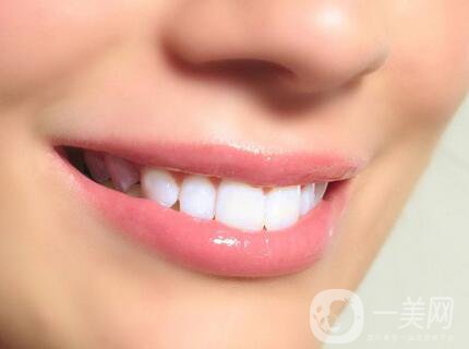 *潔牙價格多少錢一次？