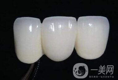 貴金屬烤瓷牙的危害有哪些？