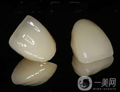 貴金屬烤瓷牙的危害有哪些？