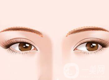 北京假體豐眉弓具體需要多少錢(qián)