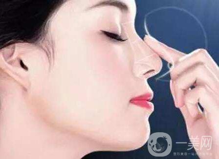 膨體隆鼻,后期*果