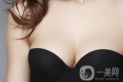 做完乳暈飄紅之后需要多久恢復正常？