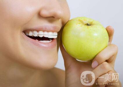 t4a可以矯正牙齒嗎？