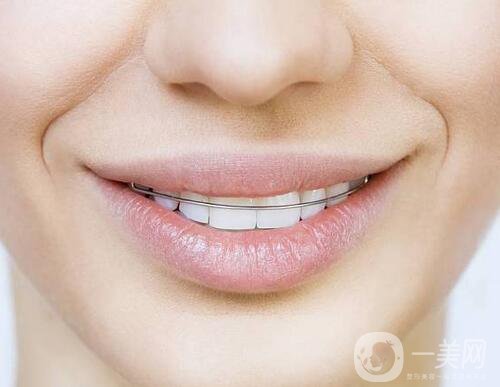 t4a可以矯正牙齒嗎？