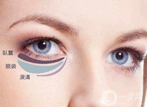 內(nèi)切祛眼袋多久恢復(fù)？