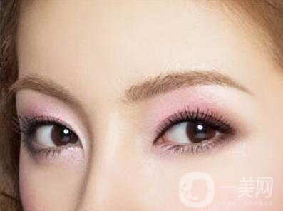 雙眼皮肉條怎么修復(fù)？