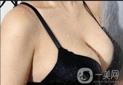 假體隆胸手術(shù)做完之后恢復(fù)期要多久時(shí)間？