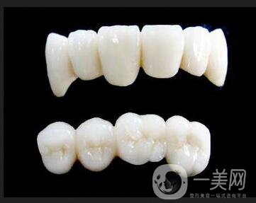 深圳做烤瓷牙一般要多少錢