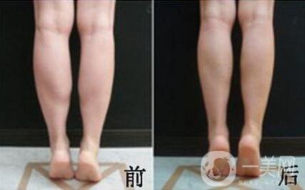 *的副作用有哪些？