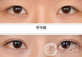 *都包含哪些項目？*整形多少錢