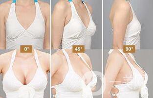 自體隆胸后多久可以上班？術(shù)后有哪些注意事項(xiàng)