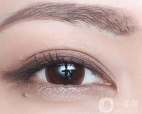 割雙眼皮術(shù)后注意事項有哪些？