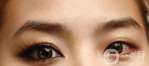 開眼角,風(fēng)險(xiǎn)