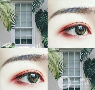 埋線雙眼皮要拆線嗎？如何護(hù)理？