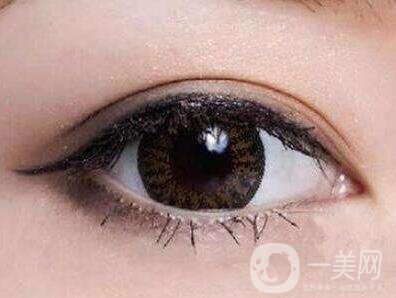 埋線雙眼皮要拆線嗎？如何護(hù)理？