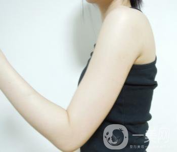 吸脂瘦手臂*果怎么樣 手術(shù)*嗎