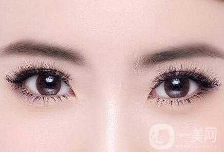 埋線雙眼皮術(shù)后護(hù)理有哪些？