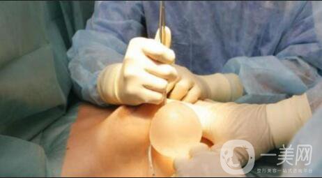 假體隆胸有哪些材料 假體有什么危害 