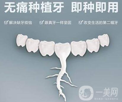 上海,全口種植牙,價格