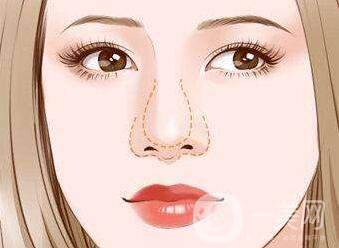 怎么縮小鼻翼？縮小鼻翼術(shù)后護(hù)理