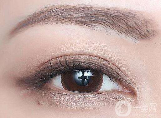 全切雙眼皮能維持多久？